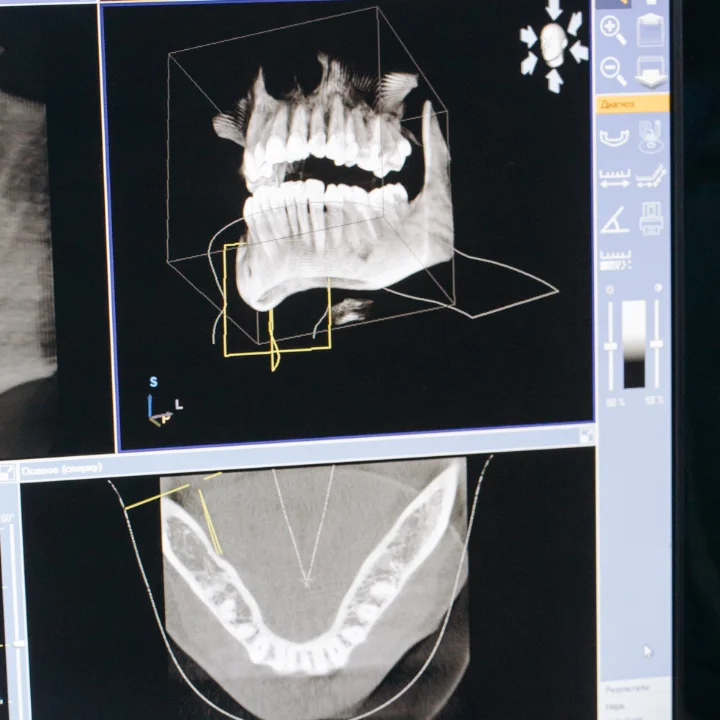 Цифровые технологии в стоматологии
